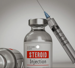 Steroid Injections